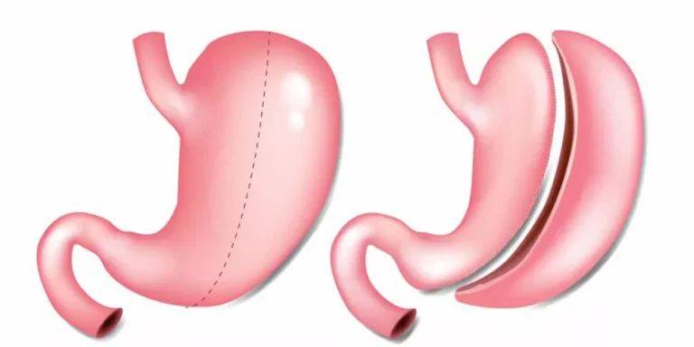 ما هو التكميم الطبيعي وفوائده؟