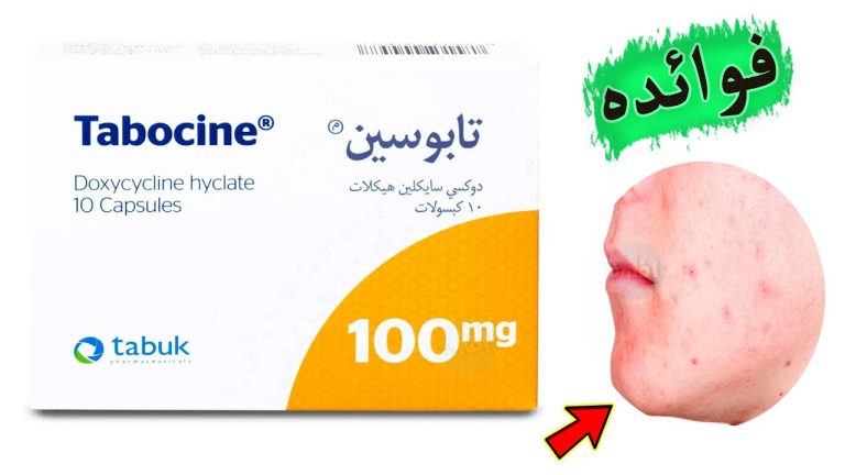 فوائد تابوسين لحب الشباب